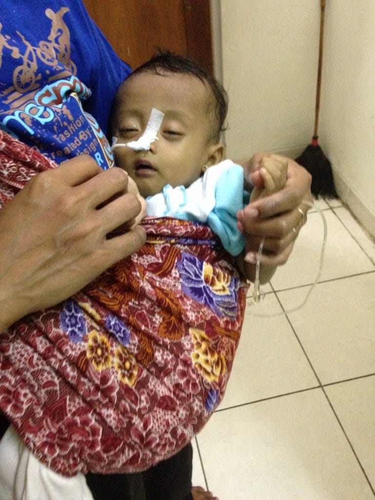 Bantuan untuk Dek Kholifah yang Terkena Gizi Buruk & Cholestasis (Penyumbatan Saluran Empedu)