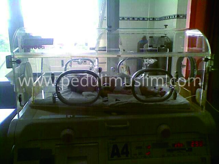 Bantuan untuk Bayi “Baiq Yumna” yang Terkena Pendarahan di Otak